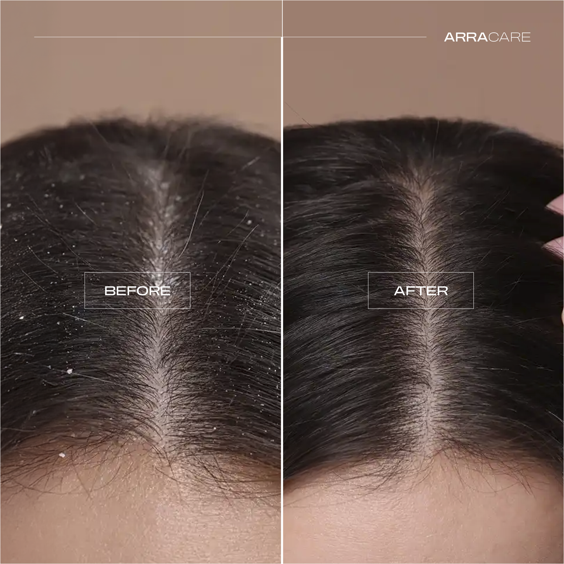 Gentle Anti-Dandruff Shampoo | Hydrating, Soothing & Fresh