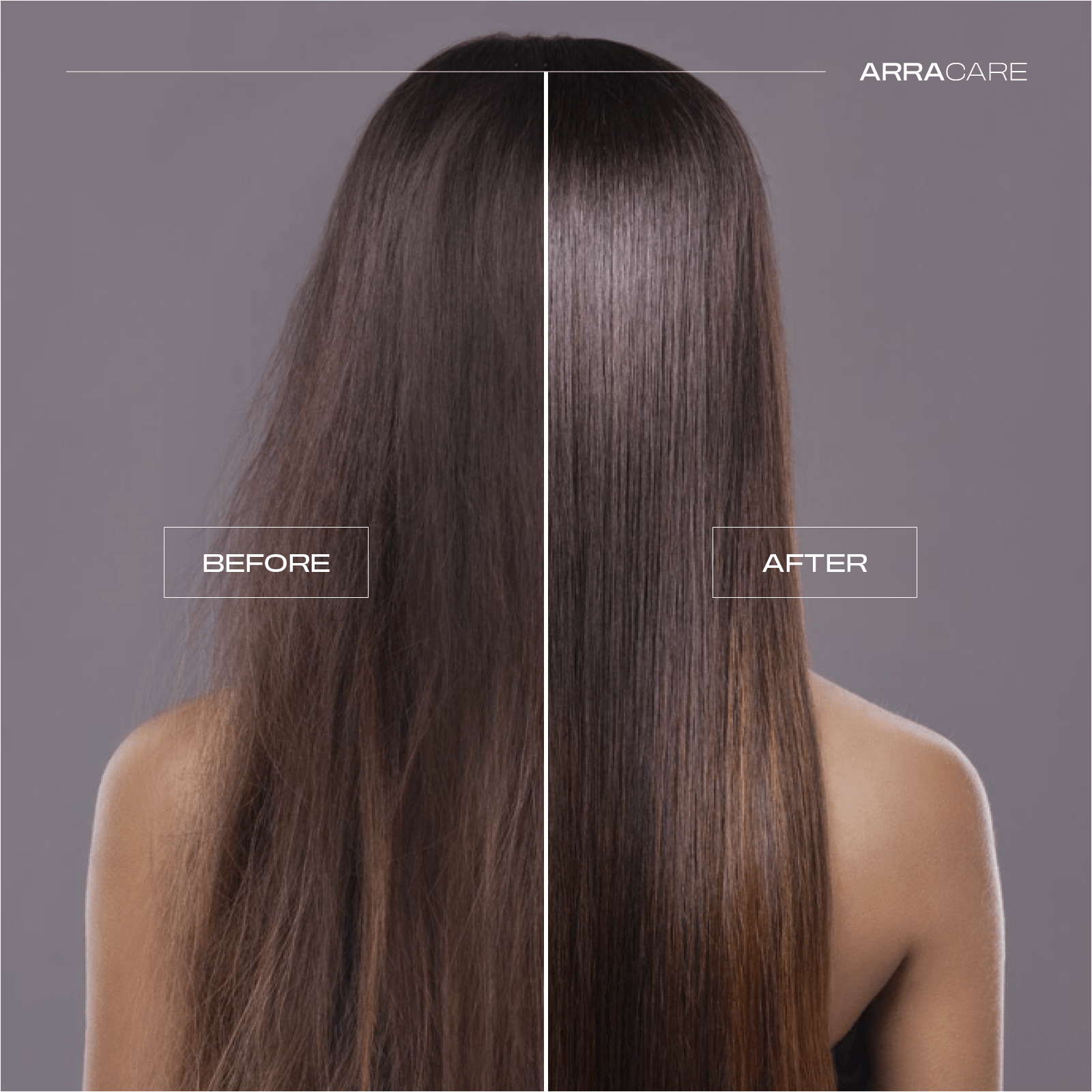 Gentle Anti-Dandruff Shampoo | Hydrating, Soothing & Fresh
